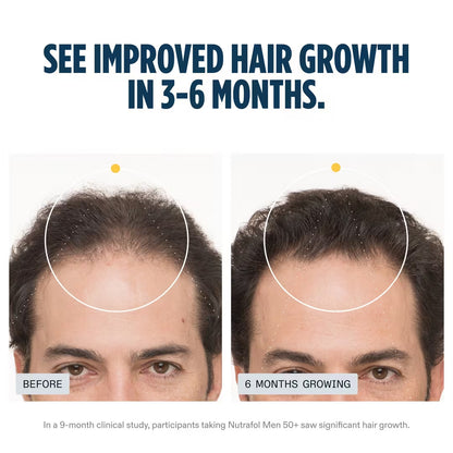 Nutrafol Men 50+ Hair Growth Nutraceutical