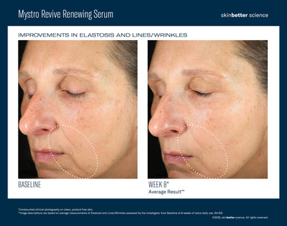 skinbetter Mystro Revive Renewing Serum