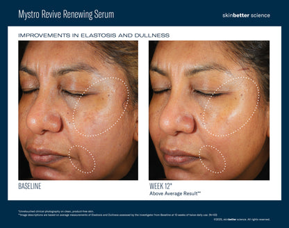 skinbetter Mystro Revive Renewing Serum