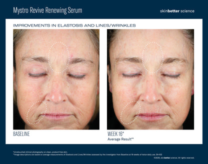 skinbetter Mystro Revive Renewing Serum