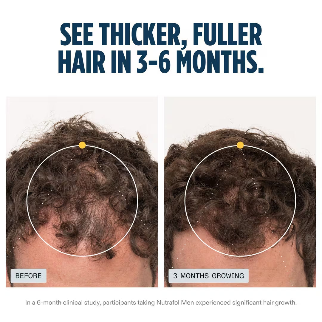 Nutrafol Men's Hair Growth Pack