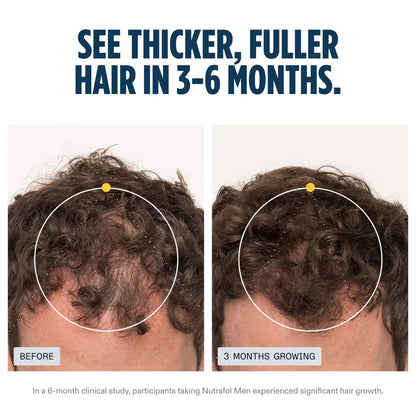 Nutrafol Men's Hair Growth Pack