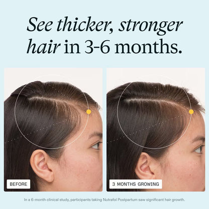 Nutrafol Postpartum Hair Growth Nutraceutical Supplement