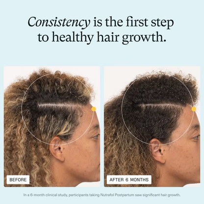 Nutrafol Postpartum Hair Growth Nutraceutical Supplement