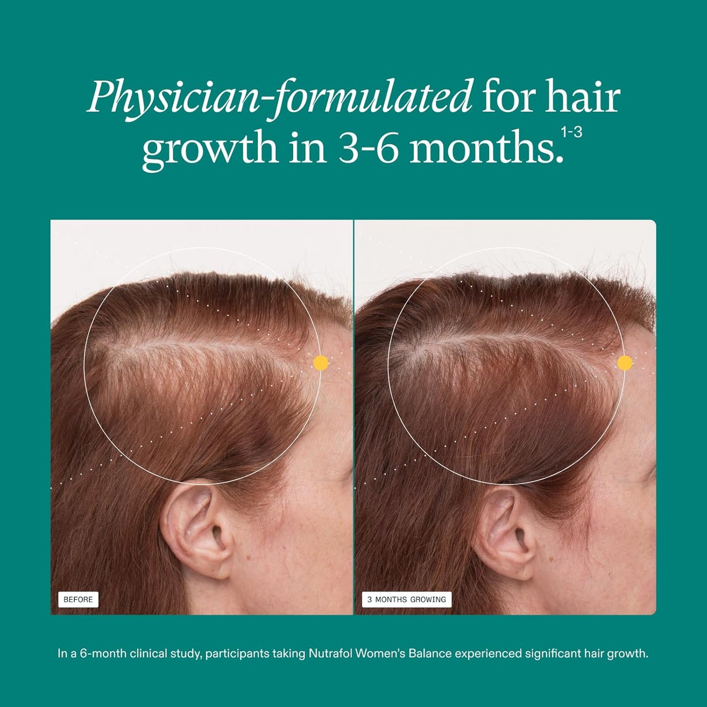 Nutrafol Women's Balance Hair Growth Nutraceutical