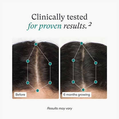 Nutrafol Women’s Hair Growth Nutraceutical Supplement