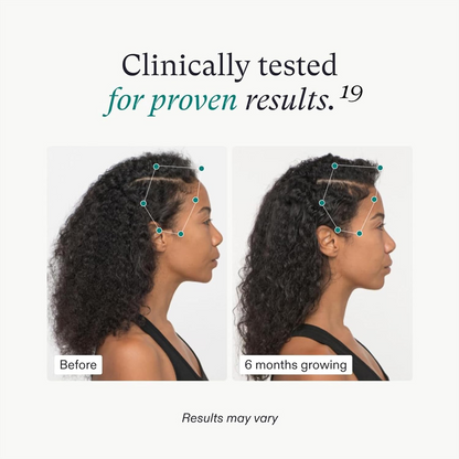 Nutrafol Women’s Vegan Hair Growth Nutraceutical Supplement