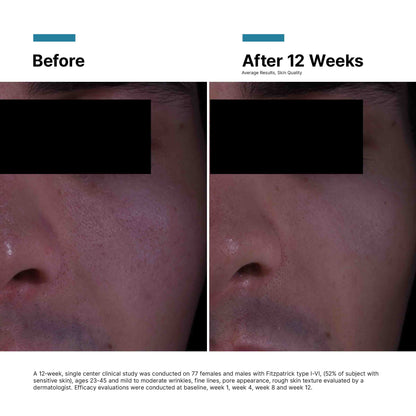 SkinCeuticals P-TIOX Cream