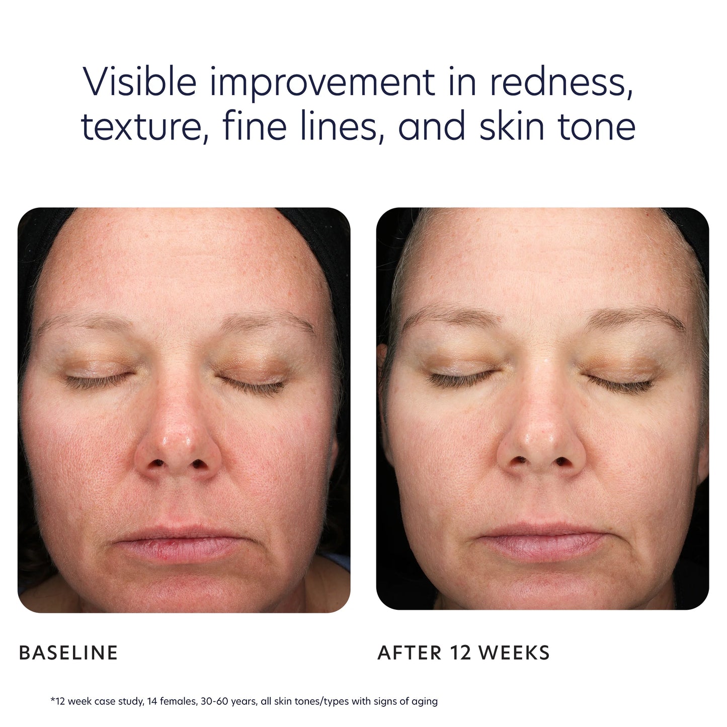 PCA Skin Triple Exfoliation Peel Pads