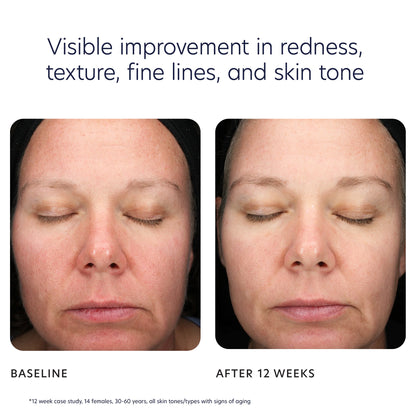 PCA Skin Triple Exfoliation Peel Pads