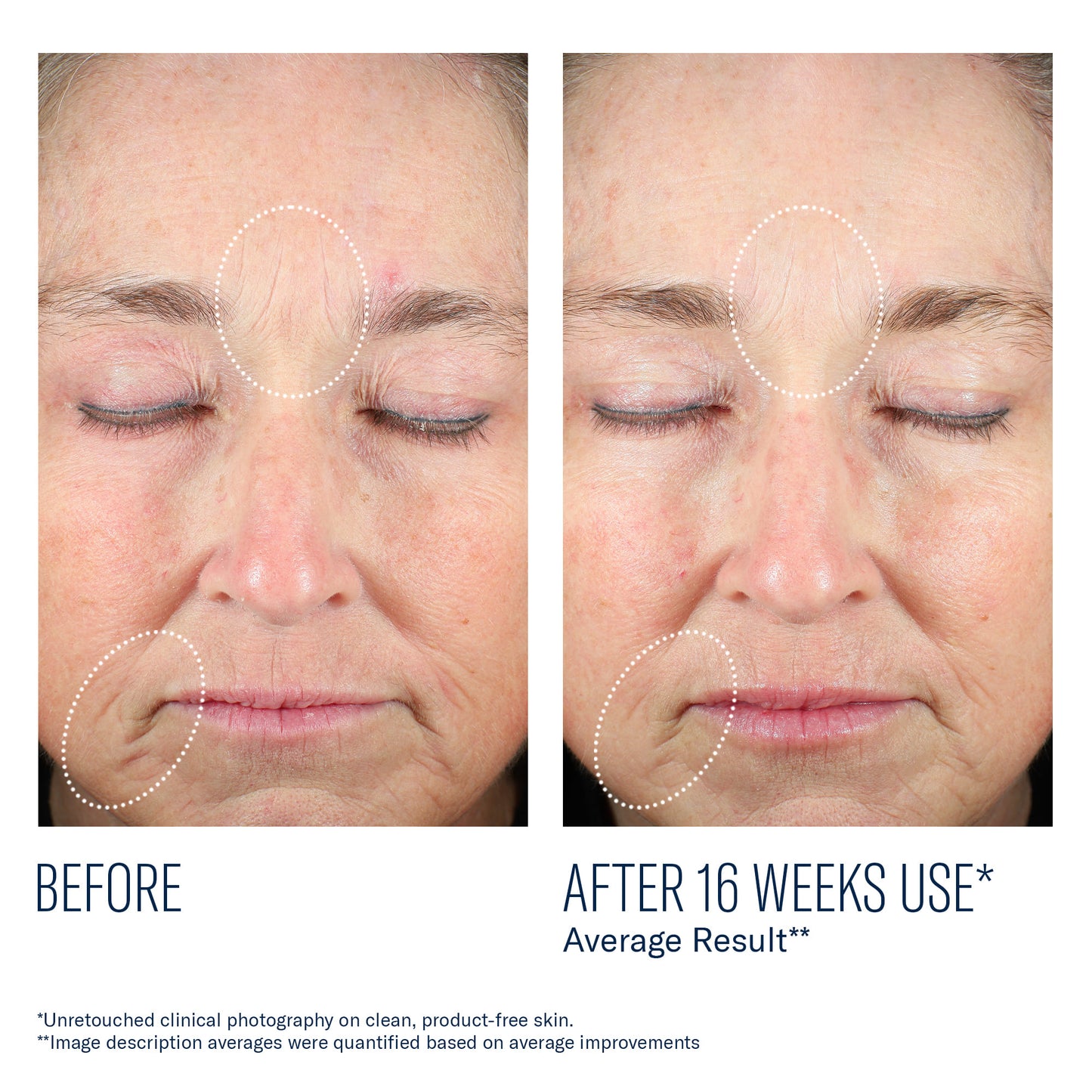 skinbetter Mystro Revive Renewing Serum