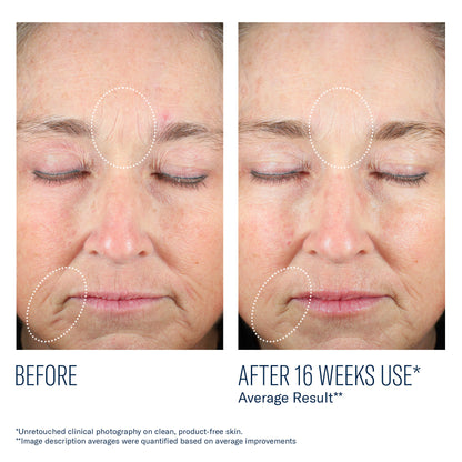 skinbetter Mystro Revive Renewing Serum