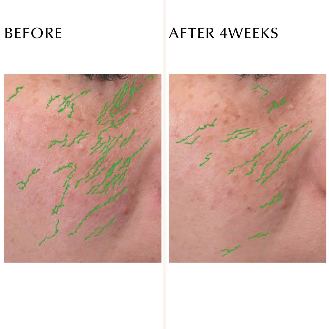 ALBION Excia Double Key Advance Serum