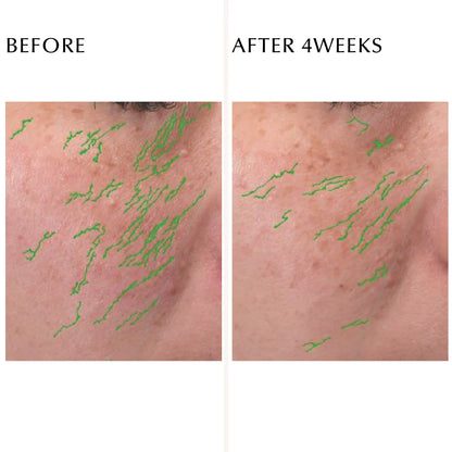 ALBION Excia Double Key Advance Serum
