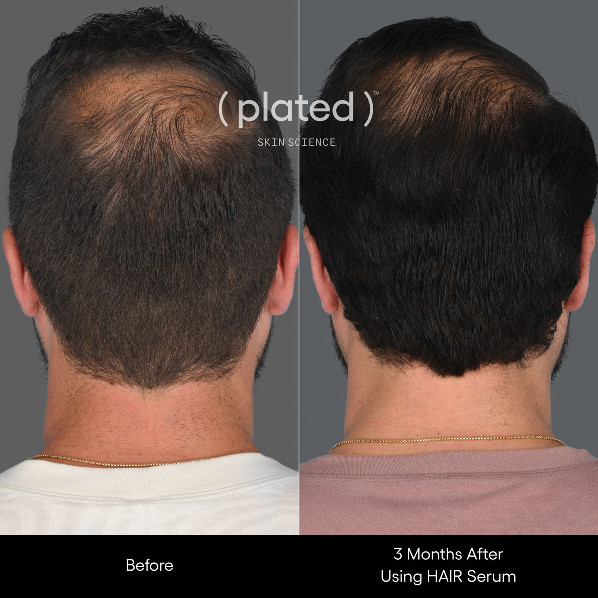 ( plated ) Skin Science HAIR Serum