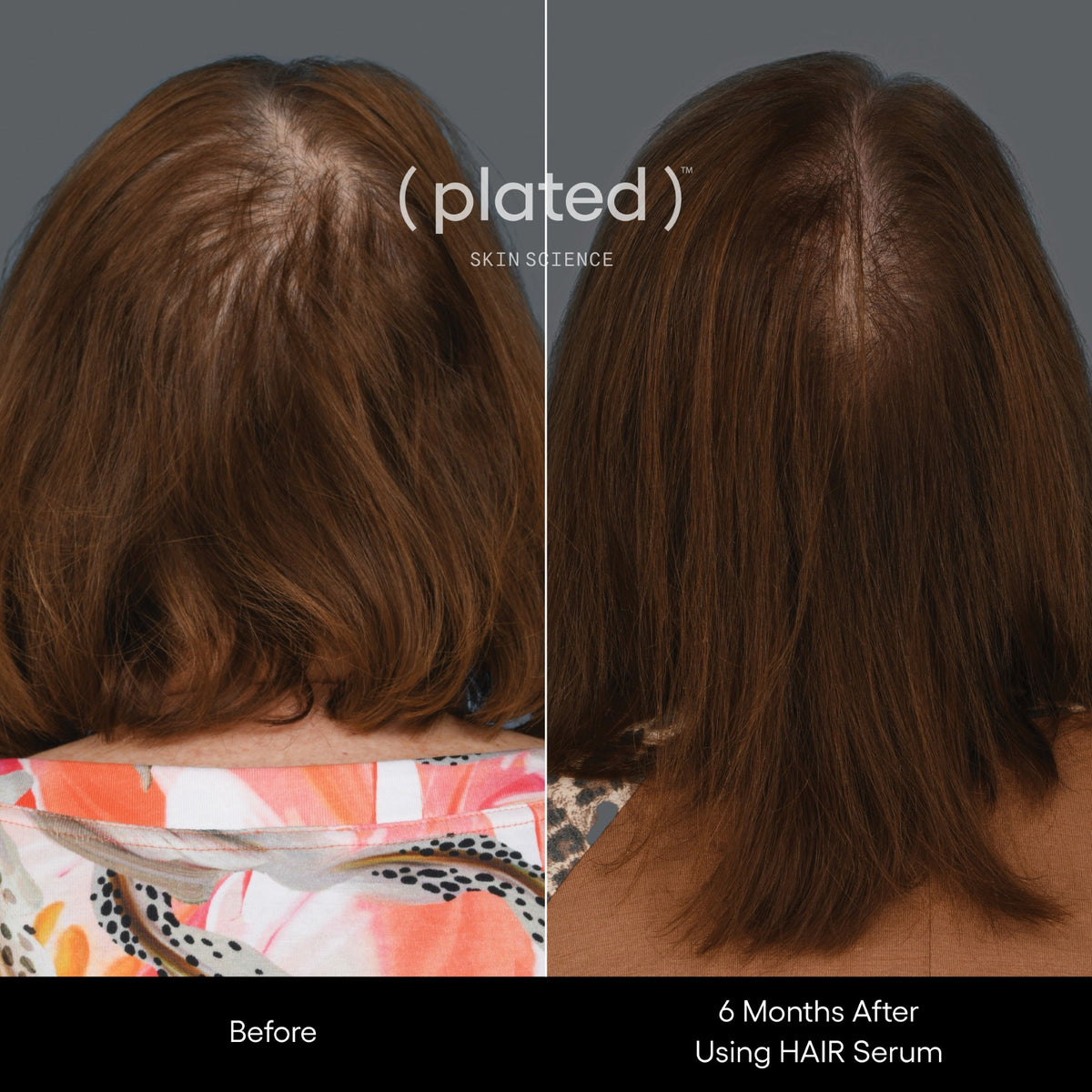 ( plated ) Skin Science HAIR Serum