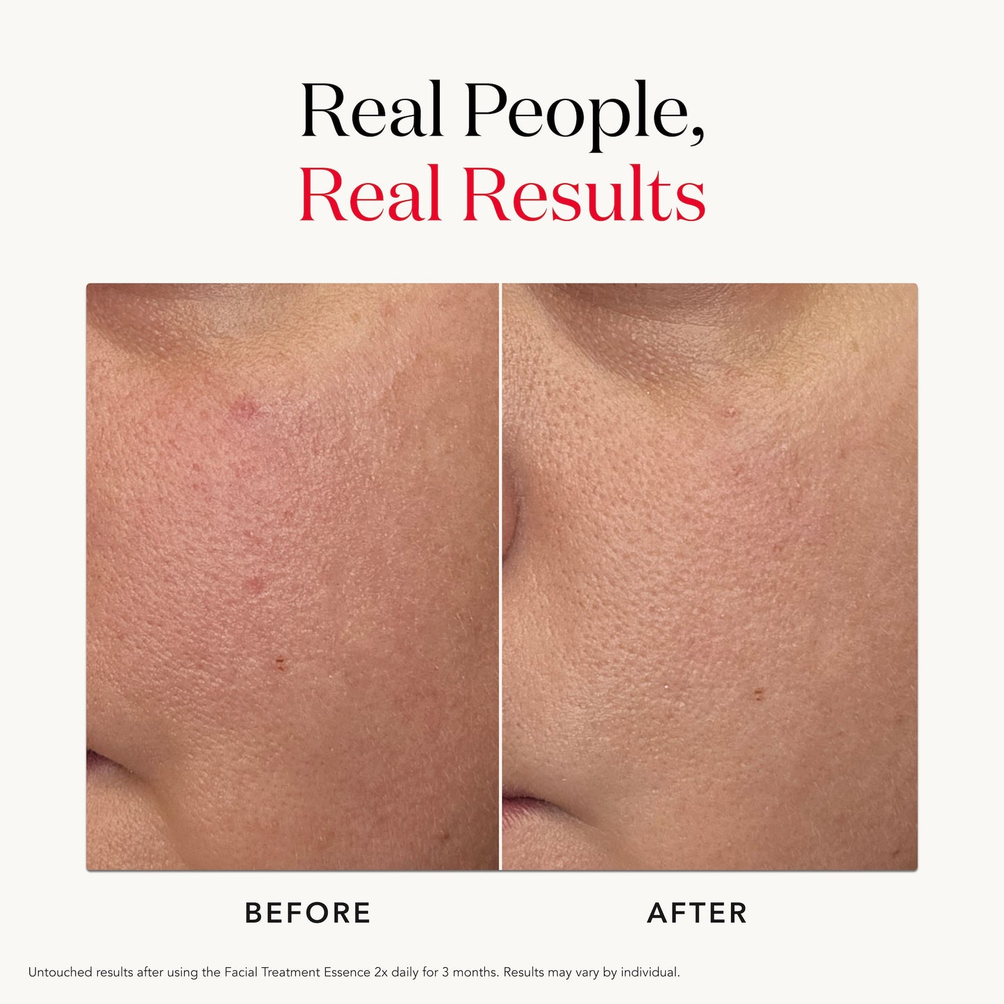 SK-II PITERA™ Facial Treatment Essence