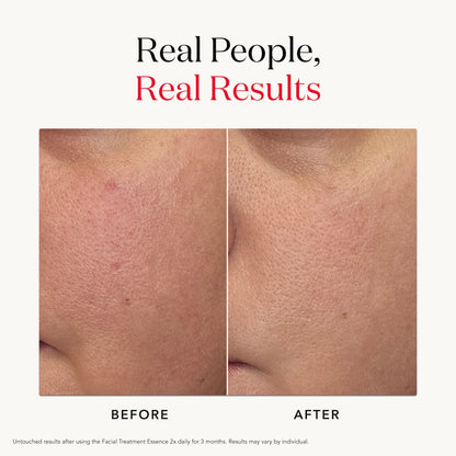 SK-II PITERA™ Facial Treatment Essence