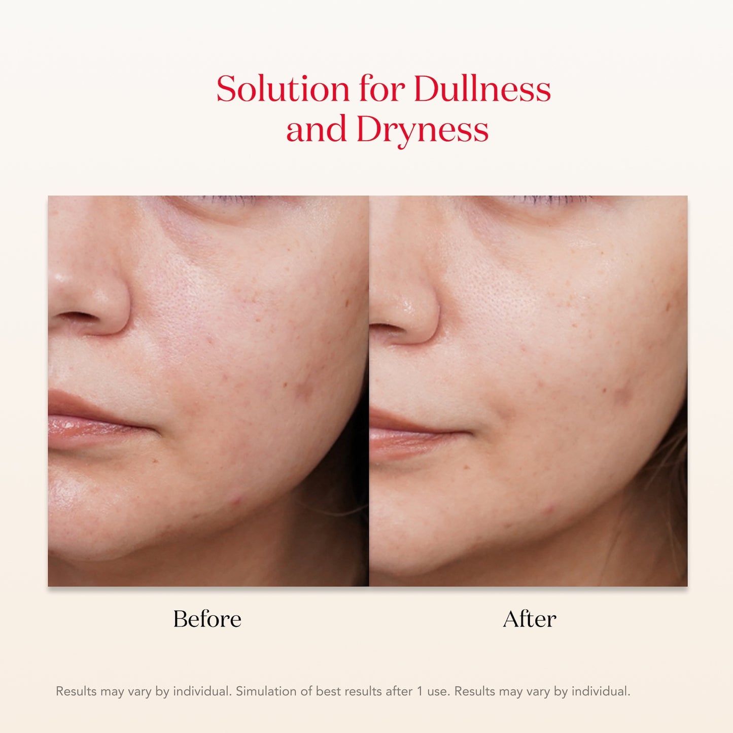 SK-II PITERA™ Facial Treatment Mask