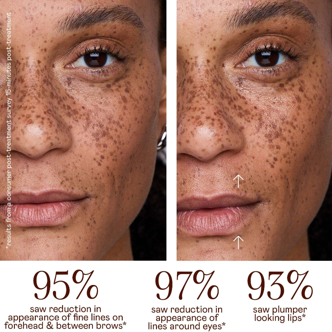NuFACE FIX MicroWand