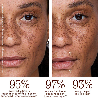 NuFACE FIX MicroWand