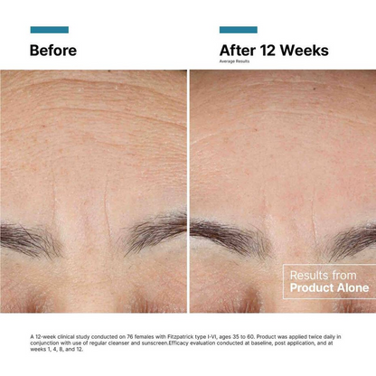 SkinCeuticals Advanced RGN-6