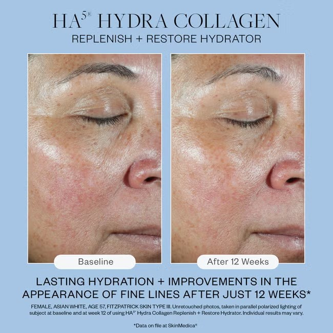 SkinMedica HA5 Hydra Collagen Replenish + Restore Hydrator