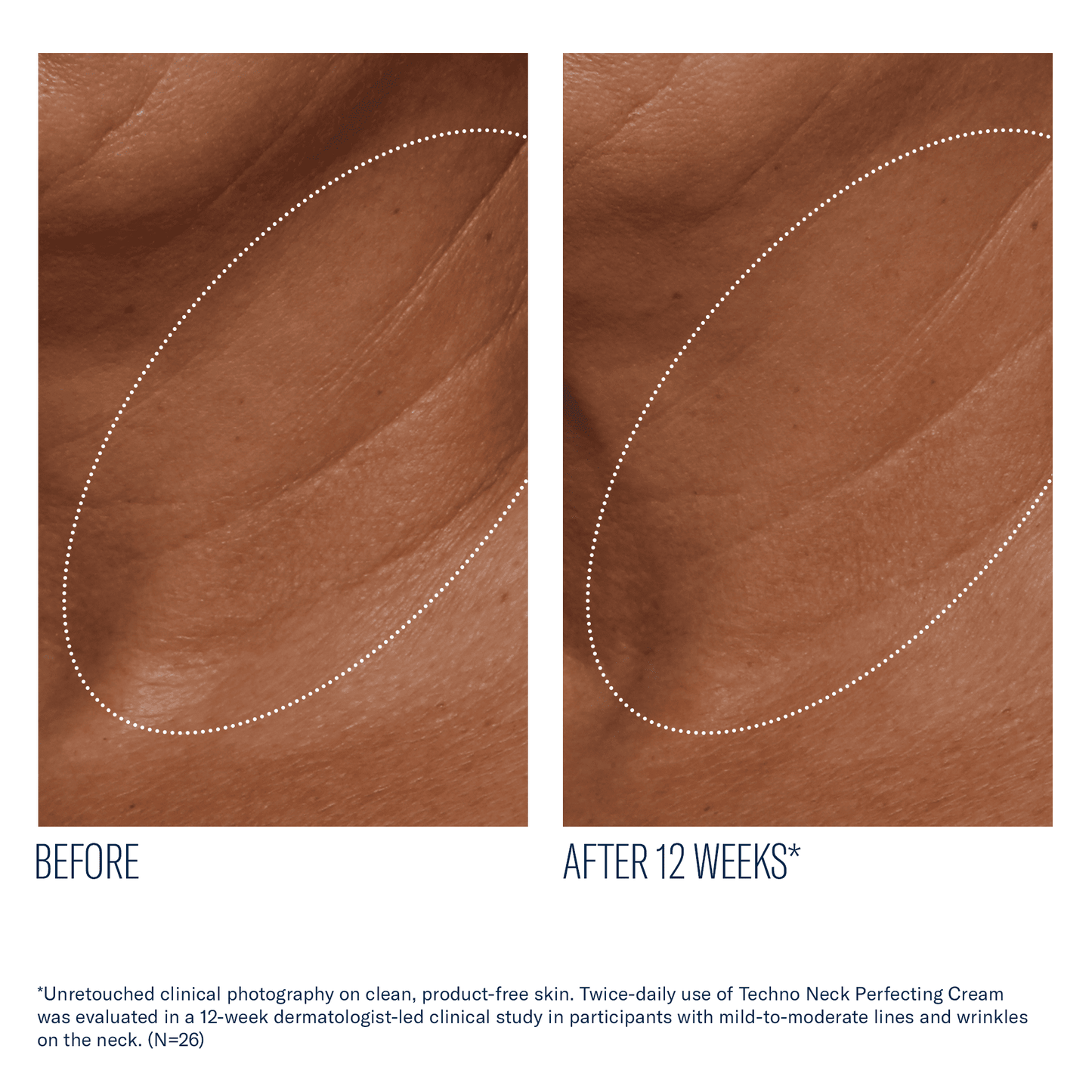 skinbetter Techno Neck Perfecting Cream