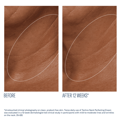 skinbetter Techno Neck Perfecting Cream