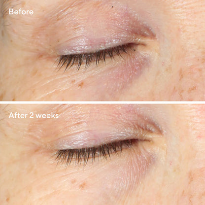 Murad Vita-C Eyes Dark Circle Corrector