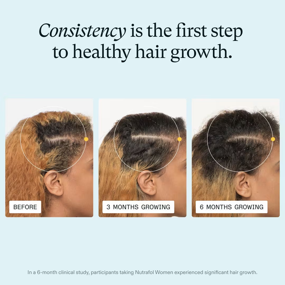 Nutrafol Women’s Hair Growth Pack