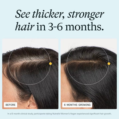 Nutrafol Women’s Vegan Hair Growth Nutraceutical Supplement