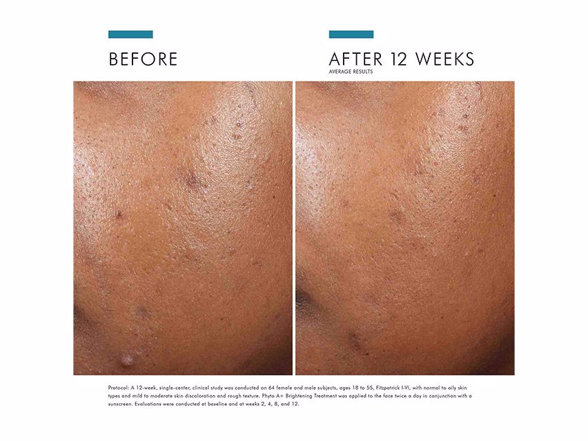 SkinCeuticals Phyto A+ Brightening Treatment