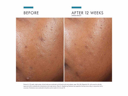 SkinCeuticals Phyto A+ Brightening Treatment