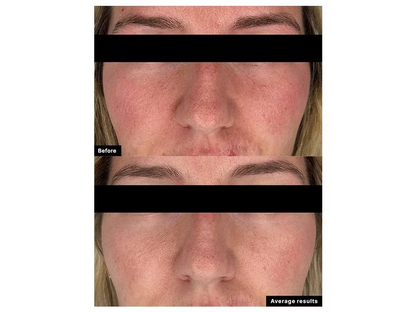 SkinCeuticals Clear Daily Soothing UV Defense Sunscreen SPF 50