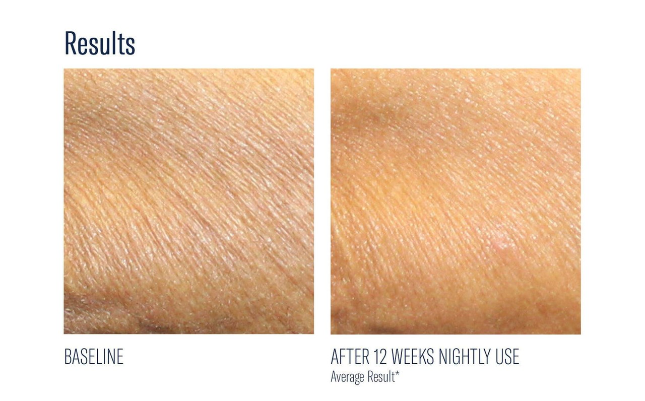 Skinbetter AlphaRet Body Overnight Cream