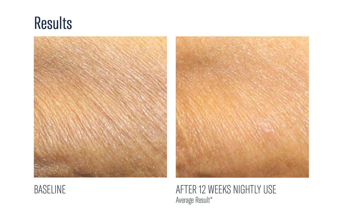 skinbetter AlphaRet Body Overnight Cream