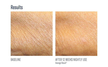 skinbetter AlphaRet Body Overnight Cream