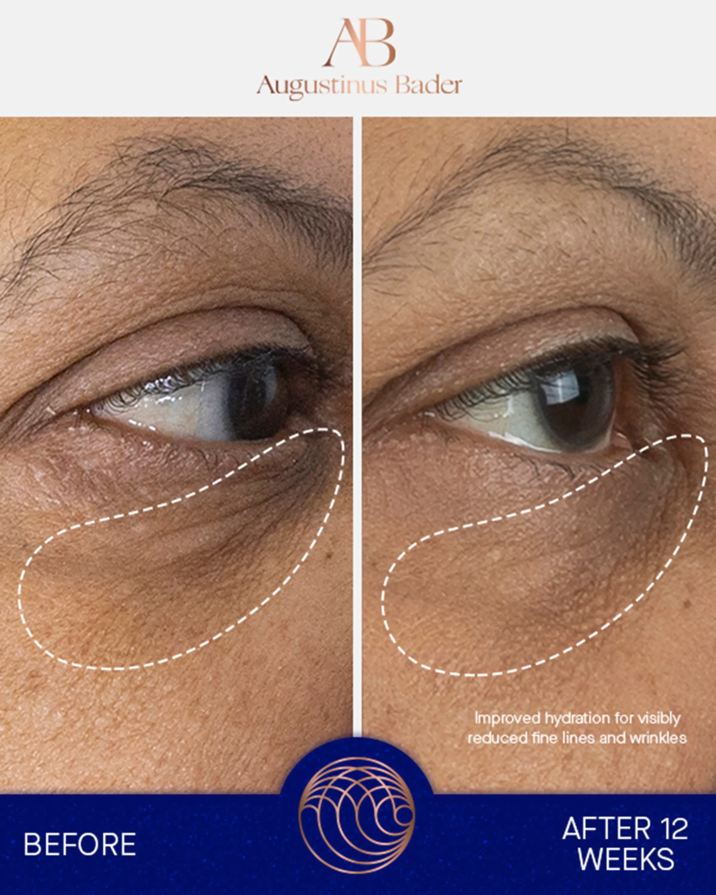 Augustinus Bader The Eye Cream Refill Success