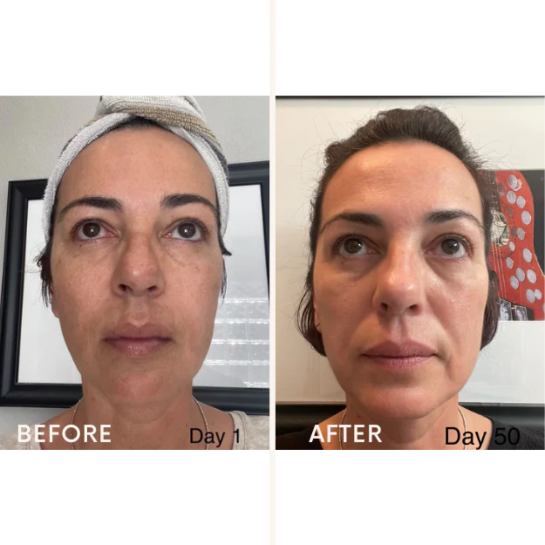 Skincare Junkie Discoloration Fade Wand