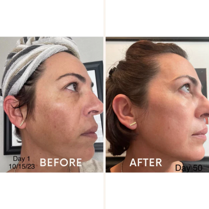 Skincare Junkie Discoloration Fade Wand