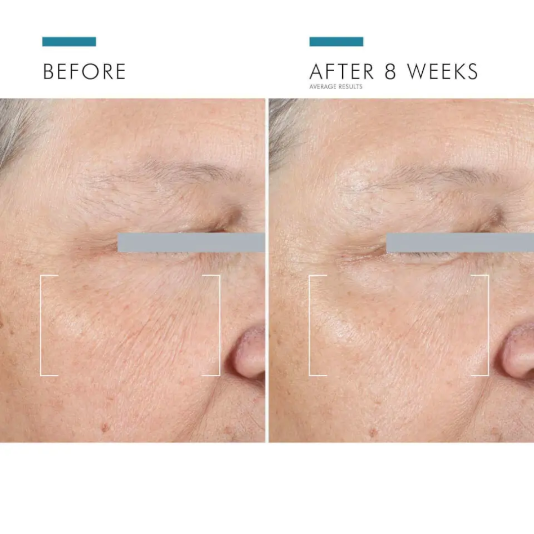 SkinCeuticals A.G.E. Advanced Eye