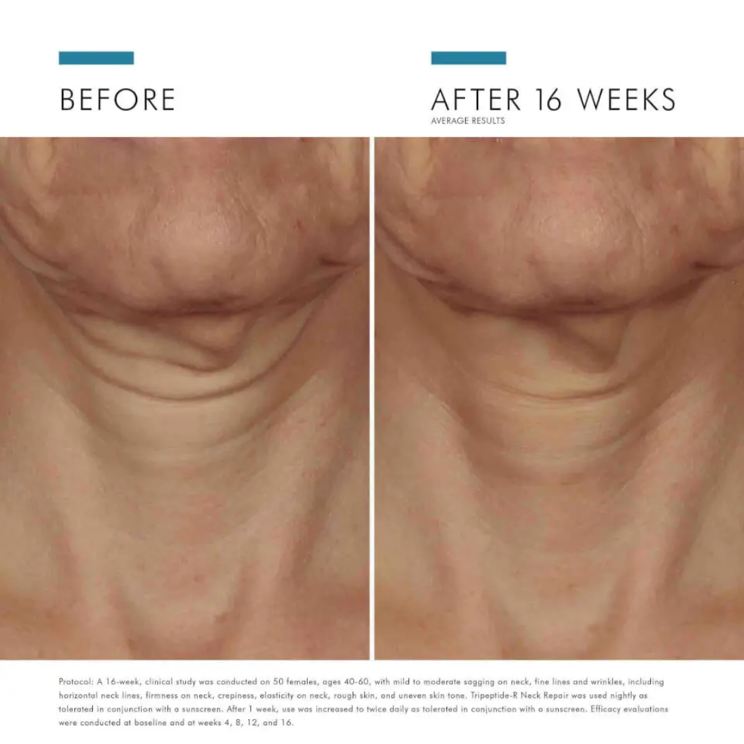 SkinCeuticals Tripeptide-R Neck Repair