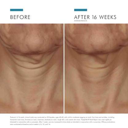 SkinCeuticals Tripeptide-R Neck Repair