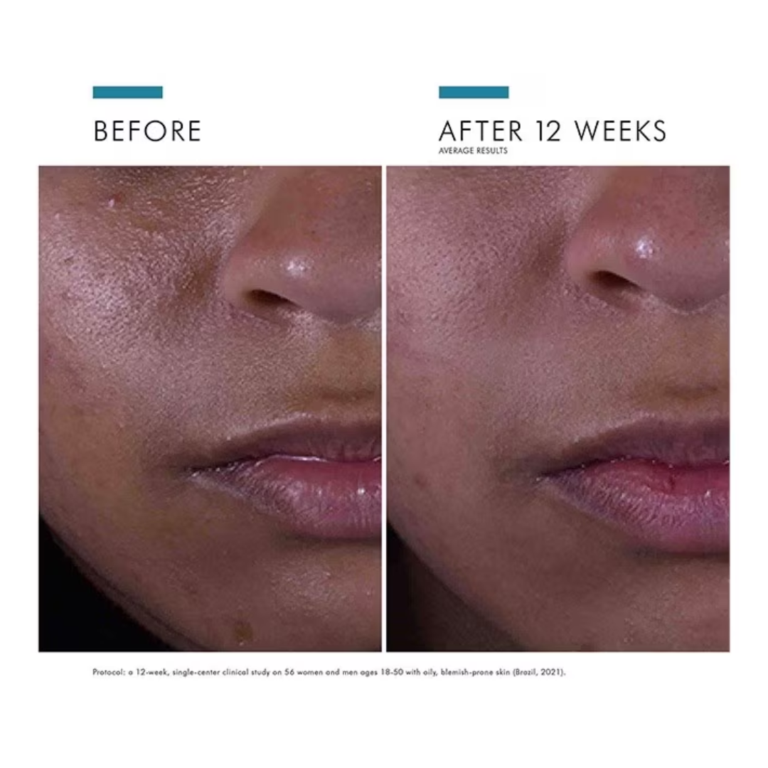 SkinCeuticals Silymarin CF