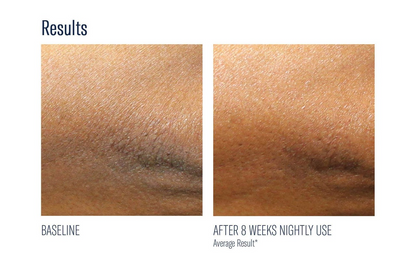 Skinbetter AlphaRet Body Overnight Cream