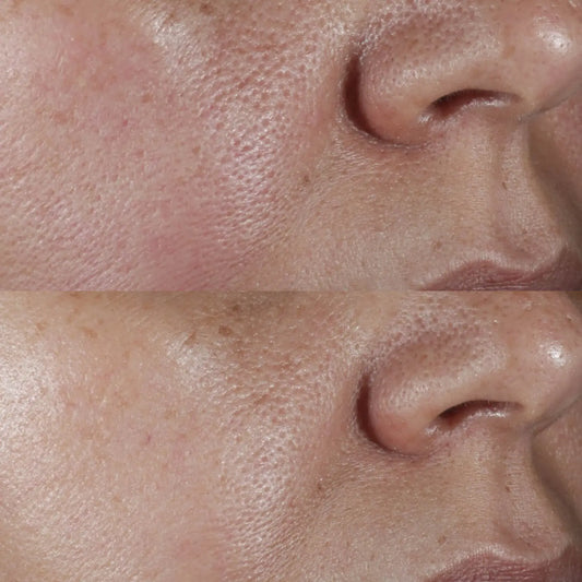 Perricone MD No Rinse Pore Minimizing Toner
