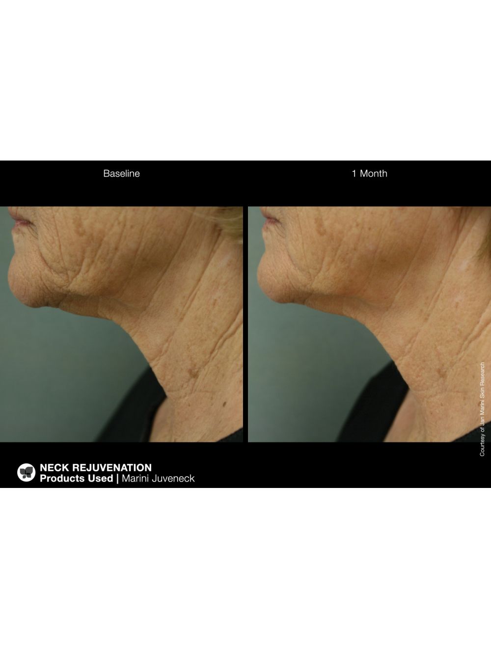 Jan Marini Marini Juveneck