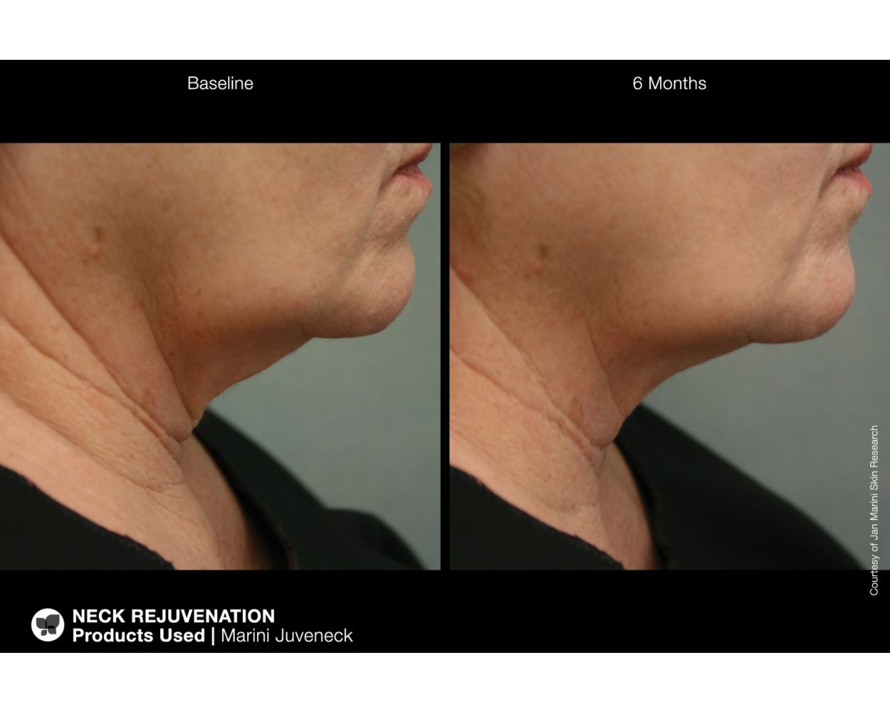 Jan Marini Marini Juveneck