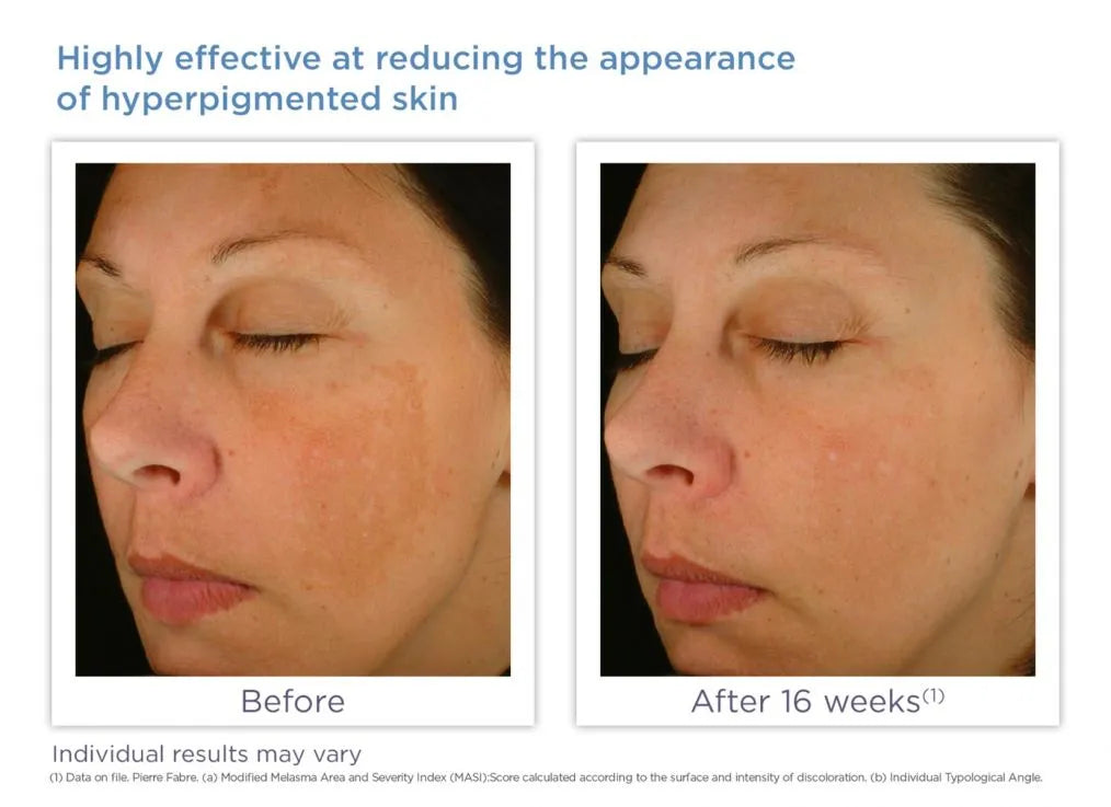 Glytone Enhance Brightening Complex